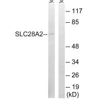 Western blot analysis of extracts from Jurkat cells, using SLC28A2 antibody.