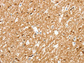 The image on the left is immunohistochemistry of paraffin-embedded Human brain tissue using CSB-PA292485(AMZ1 Antibody) at dilution 1/80, on the right is treated with synthetic peptide. (Original magnification: ×200)