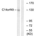Western blot analysis of extracts from Jurkat cells, using C14orf49 antibody.