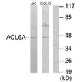 Western blot analysis of extracts from Jurkat cells and COLO205 cells, using ACL6A antibody.