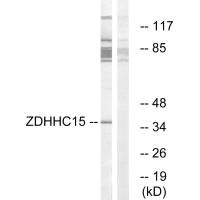 Western blot analysis of extracts from Jurkat cells, using ZDHHC15 antibody.