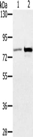 Gel: 6%SDS-PAGE, Lysate: 40 ug, Lane 1-2: Human testis tissue, K562 cells, Primary antibody: CSB-PA295128(CARF Antibody) at dilution 1/300, Secondary antibody: Goat anti rabbit IgG at 1/8000 dilution, Exposure time: 2 minutes