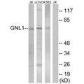 Western blot analysis of extracts from Jurkat cells, LOVO cells and K562 cells, using GNL1 antibody.