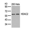 Western blot analysis of extracts from 293 and Hela cells using HDAC2(Ab-394) Antibody.