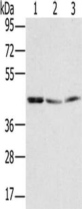 Gel: 8%SDS-PAGE, Lysate: 40 ug, Lane 1-3: K562 cells, hela cells, Jurkat cells, Primary antibody: CSB-PA296056(RBMX Antibody) at dilution 1/400, Secondary antibody: Goat anti rabbit IgG at 1/8000 dilution, Exposure time: 5 seconds