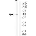 Western blot analysis of extracts from Hela cells, using PDK1 antibody.