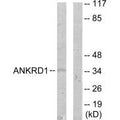 Western blot analysis of extracts from COLO205 cells, using ANKRD1 antibody.