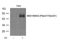 Western blot analysis of extracts from Hela cell untreated or treated with UV MEK1/MEK2(Phospho-Ser217/Ser221) Antibody