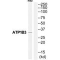 Western blot analysis of extracts from K562 cells, using ATP1B3 antibody.