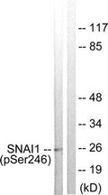Western blot analysis of extracts from HT29 cells using SNAI1 (Phospho-Ser246) Antibody.The lane on the right is treated with the antigen-specific peptide.
