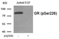 Western blot analysis of extracts from Jurkat cells treated with EGF using Phospho-GR (Ser226) antibody.The lane on the right is treated with the antigen-specific peptide.