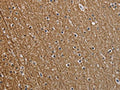 The image on the left is immunohistochemistry of paraffin-embedded Human brain tissue using CSB-PA298176(NEFM Antibody) at dilution 1/25, on the right is treated with synthetic peptide. (Original magnification: ×200)
