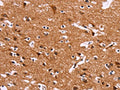 The image on the left is immunohistochemistry of paraffin-embedded Human brain tissue using CSB-PA298832(IRAK1BP1 Antibody) at dilution 1/30, on the right is treated with fusion protein. (Original magnification: ×200)