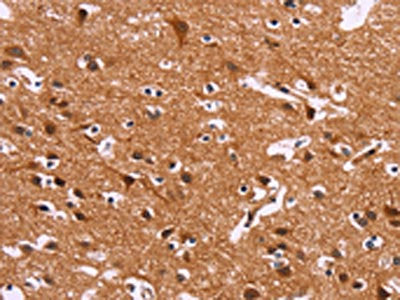 The image on the left is immunohistochemistry of paraffin-embedded Human brain tissue using CSB-PA298832(IRAK1BP1 Antibody) at dilution 1/30, on the right is treated with fusion protein. (Original magnification: ×200)