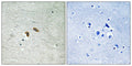 Immunohistochemical analysis of paraffin-embedded human brain tissue using C-RAF (Phospho-Thr269) antibody (left)or the same antibody preincubated with blocking peptide (right).