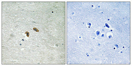 Immunohistochemical analysis of paraffin-embedded human brain tissue using C-RAF (Phospho-Thr269) antibody (left)or the same antibody preincubated with blocking peptide (right).