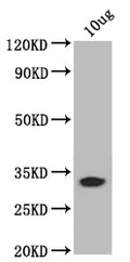 Western Blot
Positive WB detected in: recombinant protein
All lanes: bamB Antibody at 1:1000
Secondary
Goat polyclonal to rabbit IgG at 1/50000 dilution
Predicted band size: 31 kDa
Observed band size: 31 kDa