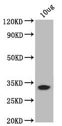 Western Blot
Positive WB detected in: recombinant protein
All lanes: bamB Antibody at 1:1000
Secondary
Goat polyclonal to rabbit IgG at 1/50000 dilution
Predicted band size: 31 kDa
Observed band size: 31 kDa