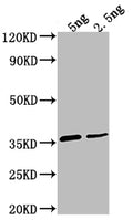 Western Blot
Positive WB detected in Recombinant protein
All lanes: D antibody at 1:2000
Secondary
Goat polyclonal to rabbit IgG at 1/50000 dilution
Predicted band size: 32.4 kDa
Observed band size: 35 kDa