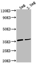 Western Blot
Positive WB detected in Recombinant protein
All lanes: D antibody at 1:2000
Secondary
Goat polyclonal to rabbit IgG at 1/50000 dilution
Predicted band size: 32.4 kDa
Observed band size: 35 kDa