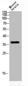 Western blot analysis of MOUSE-BRAIN lysis using ART1 antibody. Antibody was diluted at 1:2000. Secondary antibody  was diluted at 1:20000