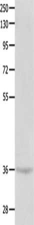Gel: 10%SDS-PAGE, Lysate: 40 ug, Lane: Mouse brain tissue, Primary antibody: CSB-PA305836(CTSG Antibody) at dilution 1/300, Secondary antibody: Goat anti rabbit IgG at 1/8000 dilution, Exposure time: 1 minute