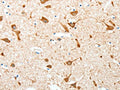The image on the left is immunohistochemistry of paraffin-embedded Human brain tissue using CSB-PA311022(AKAP4 Antibody) at dilution 1/10, on the right is treated with fusion protein. (Original magnification: ×200)