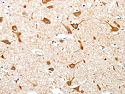 The image on the left is immunohistochemistry of paraffin-embedded Human brain tissue using CSB-PA311022(AKAP4 Antibody) at dilution 1/10, on the right is treated with fusion protein. (Original magnification: ×200)