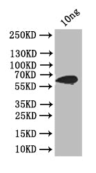 Western Blot
Positive WB detected in: recombinant protein
All lanes: ply Antibody at 1:1000
Secondary
Goat polyclonal to rabbit IgG at 1/50000 dilution
Predicted band size: 66 kDa
Observed band size: 66 kDa