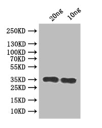 Western Blot
Positive WB detected in: recombinant protein
All lanes:RSC2 Antibody at 1:1000
Secondary
Goat polyclonal to rabbit IgG at 1/50000 dilution
Predicted band size: 32 kDa
Observed band size: 35 kDa