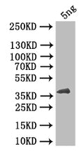Western Blot
Positive WB detected in: recombinant protein
All lanes: HBZ Antibody at 1:1000
Secondary
Goat polyclonal to rabbit IgG at 1/50000 dilution
Predicted band size: 47 kDa
Observed band size: 47 kDa