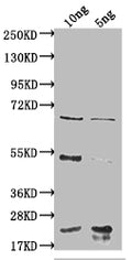 Western Blot
Positive WB detected in Recombinant protein
All lanes: degP antibody at 1:2000
Secondary
Goat polyclonal to rabbit IgG at 1/50000 dilution
Predicted band size: 62.8 kDa
Observed band size: 65 kDa