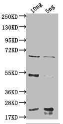 Western Blot
Positive WB detected in Recombinant protein
All lanes: degP antibody at 1:2000
Secondary
Goat polyclonal to rabbit IgG at 1/50000 dilution
Predicted band size: 62.8 kDa
Observed band size: 65 kDa