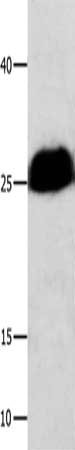 Gel: 12+15%SDS-PAGE, Lysate: 40 ug, Lane: Human cervical cancer tissue, Primary antibody: CSB-PA315068(BCL2L1 Antibody) at dilution 1/300, Secondary antibody: Goat anti rabbit IgG at 1/8000 dilution, Exposure time: 10 seconds