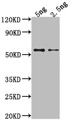 Western Blot
Positive WB detected in Recombinant protein
All lanes: GAG antibody at 1:2000
Secondary
Goat polyclonal to rabbit IgG at 1/50000 dilution
Predicted band size: 52.2 kDa
Observed band size: 51 kDa
