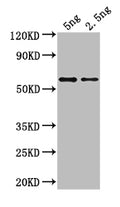 Western Blot
Positive WB detected in: recombinant protein
All lanes: gag Antibody at 1:1000
Secondary
Goat polyclonal to rabbit IgG at 1/50000 dilution
Predicted band size: 36 kDa
Observed band size: 36 kDa