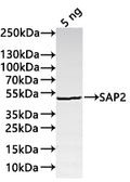 Western Blot
Positive WB detected in: recombinant protein
All lanes:SAP2 Antibody at 1:1000
Secondary
Goat polyclonal to rabbit IgG at 1/20000 dilution
Predicted band size: 42.5 kDa
Observed band size: 43 kDa