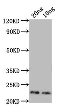 Western Blot
Positive WB detected in: recombinant protein
All lanes: Major mite allergen Der p 23 Antibody at 1:1000
Secondary
Goat polyclonal to rabbit IgG at 1/50000 dilution
Predicted band size: 20 kDa
Observed band size: 23 kDa