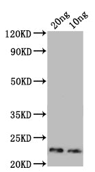 Western Blot
Positive WB detected in: recombinant protein
All lanes: Major mite allergen Der p 23 Antibody at 1:1000
Secondary
Goat polyclonal to rabbit IgG at 1/50000 dilution
Predicted band size: 20 kDa
Observed band size: 23 kDa