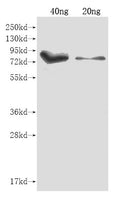 Western Blot
Positive WB detected in Recombinant protein
All lanes: iutA antibody at 1:2000
Secondary
Goat polyclonal to rabbit IgG at 1/50000 dilution
Predicted band size: 85.5 kDa
Observed band size: 85.5 kDa