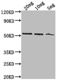 Western Blot
Positive WB detected in Recombinant protein
All lanes: lasB antibody at 1:2000
Secondary
Goat polyclonal to rabbit IgG at 1/50000 dilution
Predicted band size: 49.1 kDa
Observed band size: 52 kDa