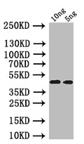 Western Blot
Positive WB detected in: recombinant protein
All lanes: oprI Antibody at 1:1000
Secondary
Goat polyclonal to rabbit IgG at 1/50000 dilution
Predicted band size: 40 kDa
Observed band size: 40 kDa