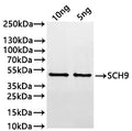 Western Blot
Positive WB detected in: recombinant protein
All lanes:SCH9 Antibody at 1:1000
Secondary
Goat polyclonal to rabbit IgG at 1/20000 dilution
Predicted band size: 40.6 kDa
Observed band size: 41 kDa