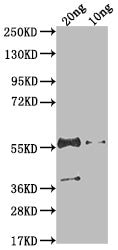 Western Blot
Positive WB detected in Recombinant protein
All lanes: N antibody at 1:2000
Secondary
Goat polyclonal to rabbit IgG at 1/50000 dilution
Predicted band size: 45.9 kDa
Observed band size: 55 kDa