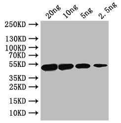 Western Blot
Positive WB detected in: recombinant protein
All lanes: porA Antibody at 1:1000
Secondary
Goat polyclonal to rabbit IgG at 1/50000 dilution
Predicted band size: 49 kDa
Observed band size: 49 kDa