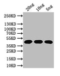 Western Blot
Positive WB detected in: recombinant protein
All lanes: N Antibody at 1:1000
Secondary
Goat polyclonal to rabbit IgG at 1/50000 dilution
Predicted band size: 44 kDa
Observed band size: 44 kDa