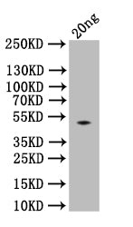 Western Blot
Positive WB detected in: recombinant protein
All lanes:spaA Antibody at 1:1000
Secondary
Goat polyclonal to rabbit IgG at 1/50000 dilution
Predicted band size: 51 kDa
Observed band size: 51 kDa