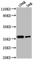 Western Blot
Positive WB detected in Recombinant protein
All lanes: RPB10 antibody at 1:2000
Secondary
Goat polyclonal to rabbit IgG at 1/50000 dilution
Predicted band size: 34.8 kDa
Observed band size: 38 kDa