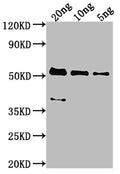 Western Blot
Positive WB detected in Recombinant protein
All lanes: MCP antibody at 1:2000
Secondary
Goat polyclonal to rabbit IgG at 1/50000 dilution
Predicted band size: 47.8 kDa
Observed band size: 53 kDa
