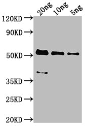 Western Blot
Positive WB detected in Recombinant protein
All lanes: MCP antibody at 1:2000
Secondary
Goat polyclonal to rabbit IgG at 1/50000 dilution
Predicted band size: 47.8 kDa
Observed band size: 53 kDa